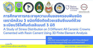 ผู้วิจัย อ.ทพญ.ศศิชานันท์ ธรรมกรบัญญัติ และ อ.ทพญ.เมทินี วิวัฒนาสิทธิพงศ์