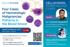 ขอเชิญเข้าร่วมฟังการบรรยาย Four Cases of Hematologic Malignancies. Patterns in the Blood Smear.  Speaker: รศ. ภาณุทรรศน์ กฤชเพชรรัตน์