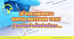 เมื่อทราบผลตรวจ rapid antigen test แล้ว ต้องทำอย่างไรกันต่อนะ ???