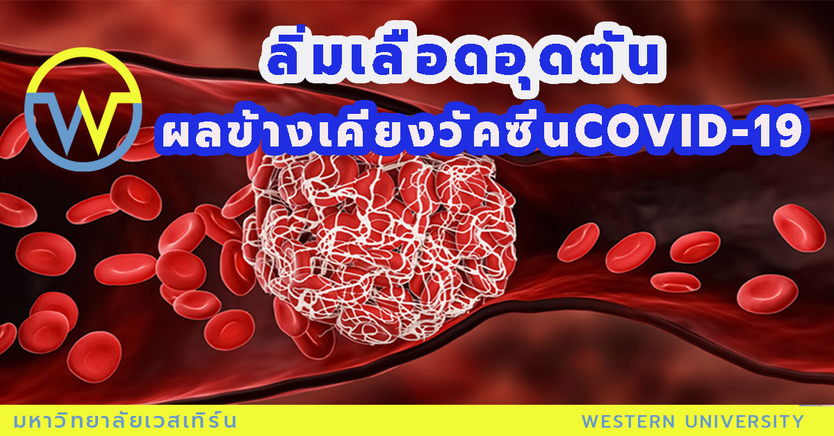ลิ่มเลือดอุดตัน ผลข้างเคียงวัคซีน COVID-19 จริงหรือ?
